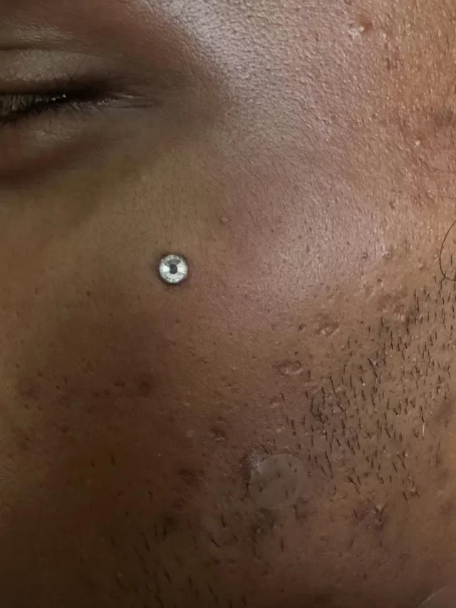 ✨ Statement made, no words needed ✨

Facial dermals are all about placement and precision. Two weeks ago, we got to do this stunning facial dermal for Ethan, and this one is settling beautifully — adding just the right sparkle without stealing the whole show.

💎 Clear CZ dermal top for a bold yet refined look
🔒 Anchored with care for long-term wear
🌟 Subtle, striking, and uniquely you

Not every piercing has to be loud. Sometimes, it’s that one well-placed detail that turns heads.

Swipe ➡️ to see how nice and flat it sits😍🙌🏼❤️
Done out of @thetattoogallerysa 

#dermal #dermalpiercing #facialdermal #bodymodification #precision #flat #facial #piercing #pierced #cz #statementmade #modmonkey #modifiedmonkey #thetattoogallery